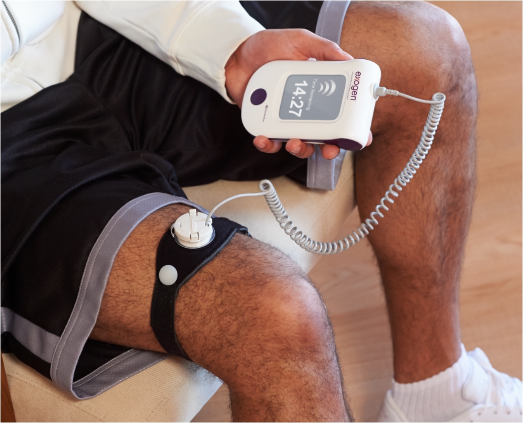 Exogen Bone Stimulator, The Knee Clinic