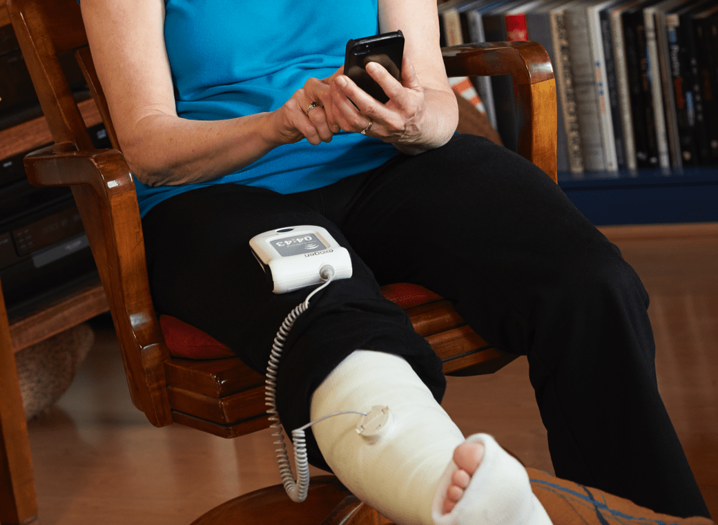 EXOGEN BONE STIMULATOR - Befitting You