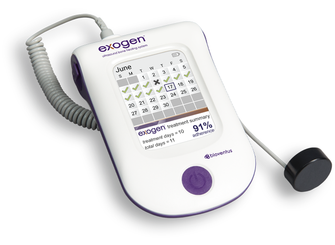 EXOGEN Ultrasound Bone Healing System | Get EXOGEN Now