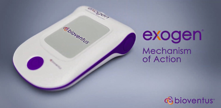 EXOGEN Ultrasound Bone Healing System | Mechanism of Action Video