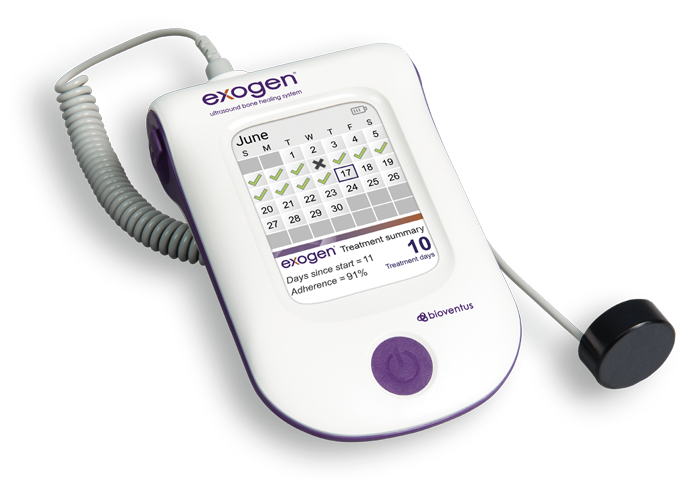 What is Exogen  EXOGEN Ultrasound Bone Healing System